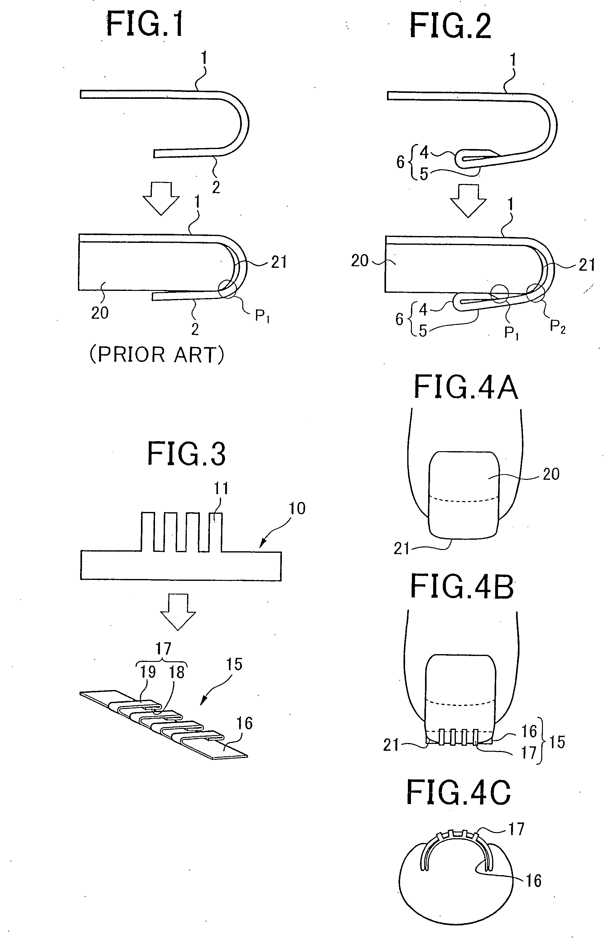 Corrective Device for Deformed Nails