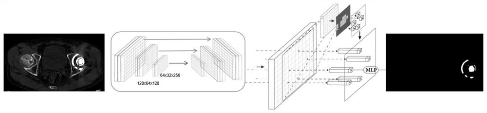 Total hip replacement revision preoperative planning method and equipment based on deep learning