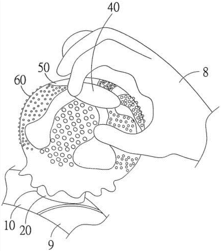 Steering wheel assist device