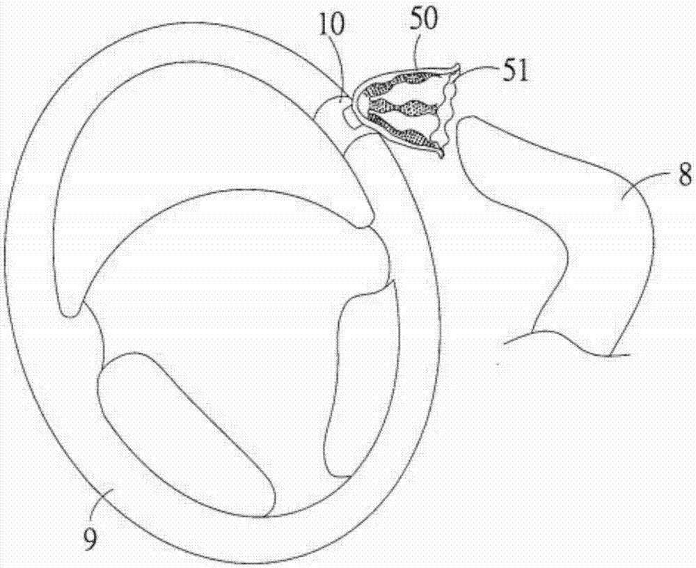 Steering wheel assist device