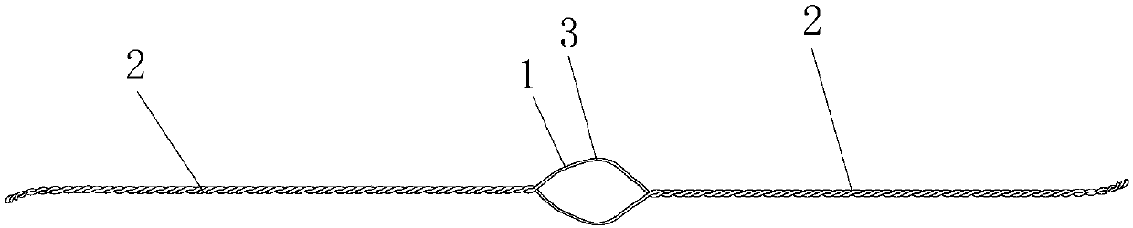 Fixing and binding band for femoral lesser trochanter bone fracture reduction