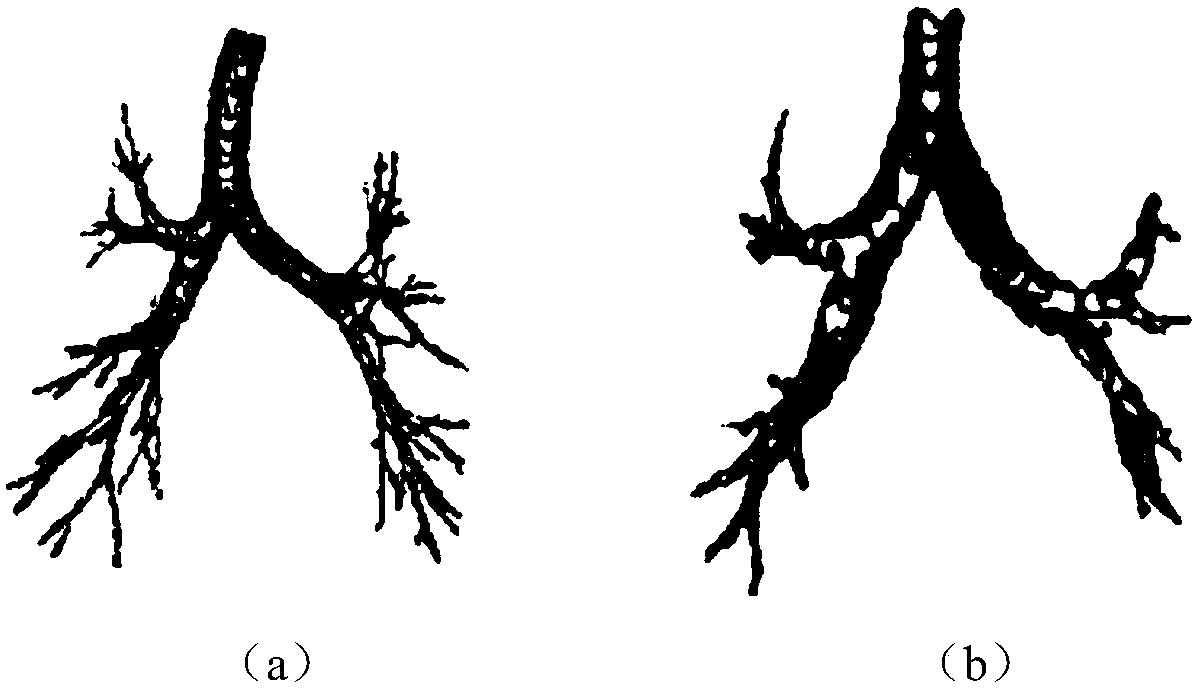 Chronic obstructive pulmonary disease prediction method based on reconstructed airway tree images