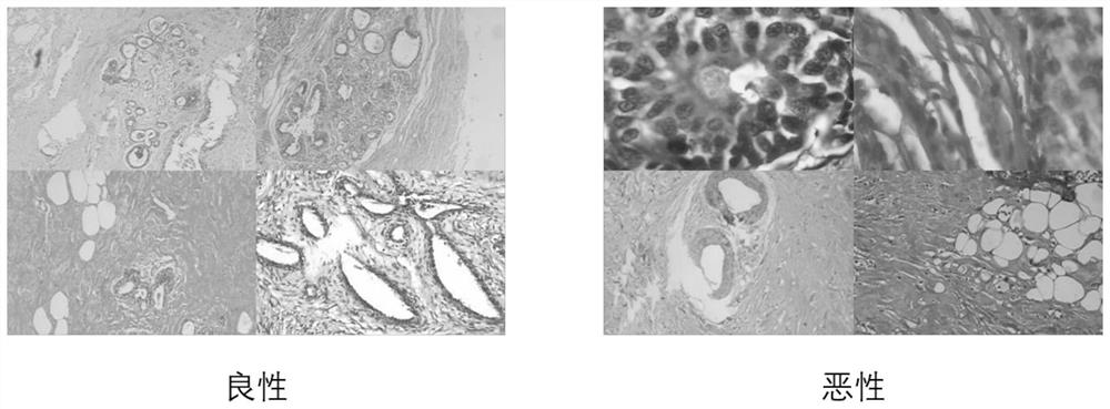 Histopathology image classification method based on color deconvolution and self-attention model