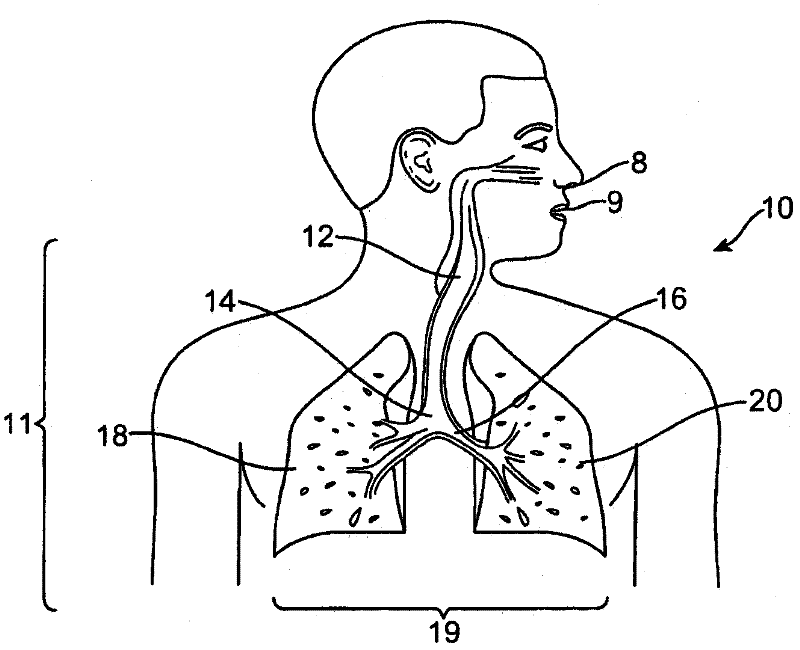 Improved and/or longer minimally invasive lung volume reduction devices and their delivery