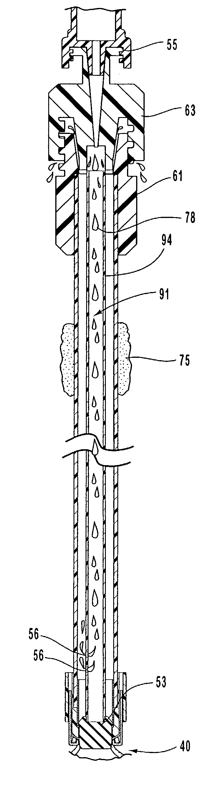 Apparatus and methods for occluding an access tube anastomosed to sidewall of an anatomical vessel