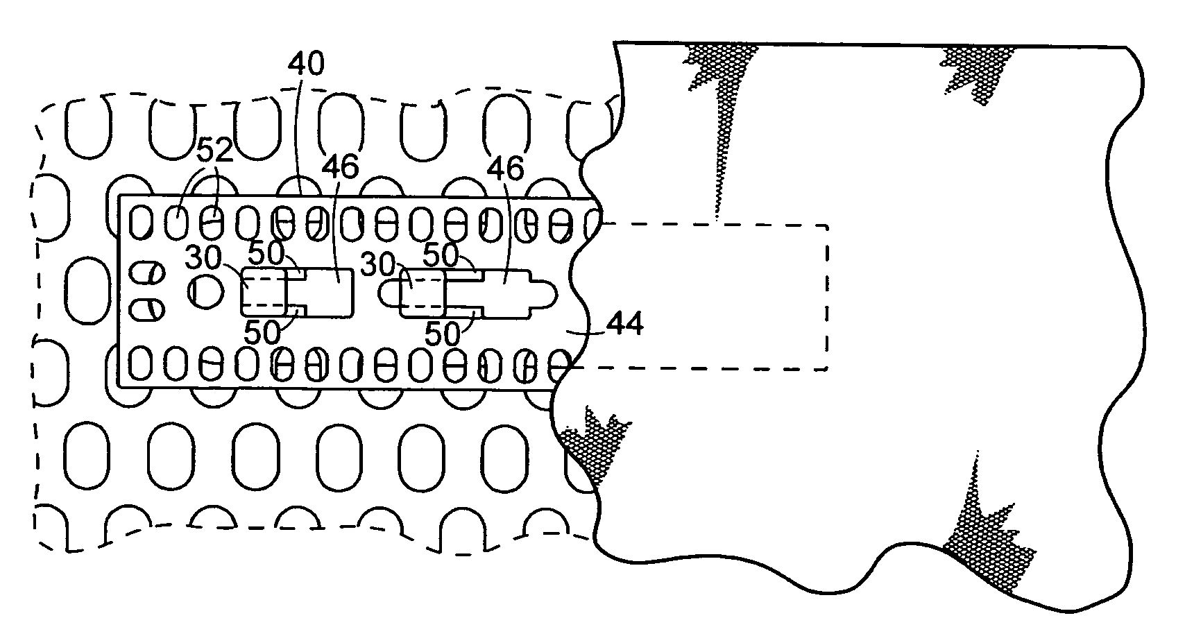 Modular attachment assembly