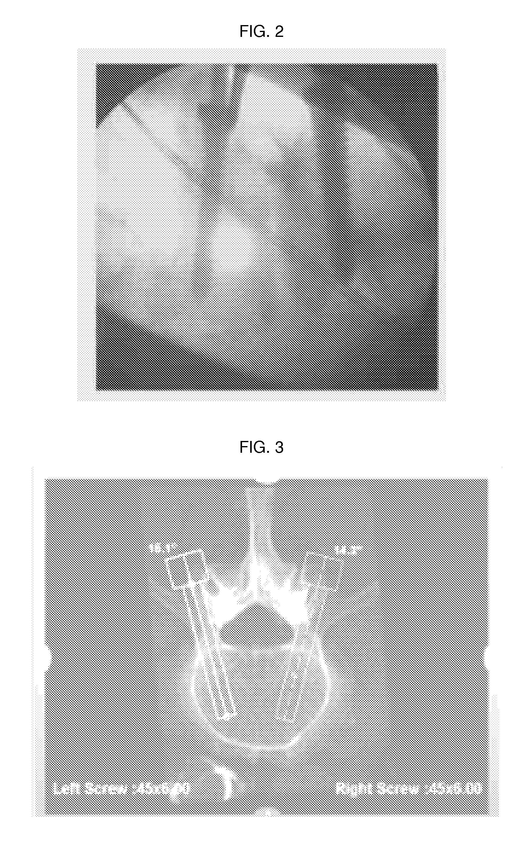 On-site verification of implant positioning