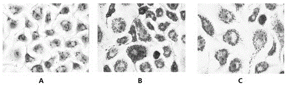 Compound liver-protecting traditional Chinese medicine for treating non-alcoholic fatty liver disease (NAFLD)