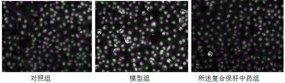 Compound liver-protecting traditional Chinese medicine for treating non-alcoholic fatty liver disease (NAFLD)