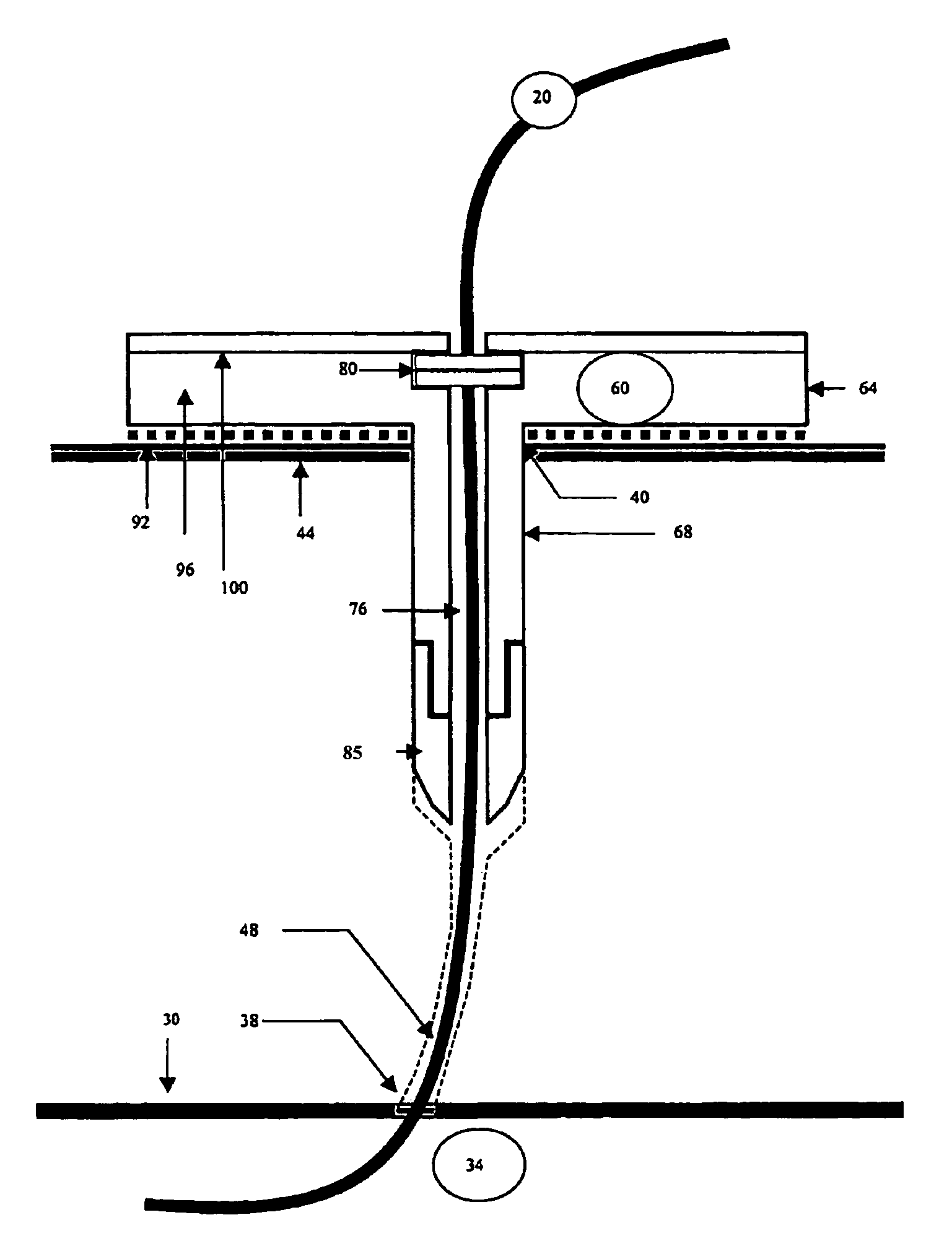 Hemostatic wire guided bandage and method of use