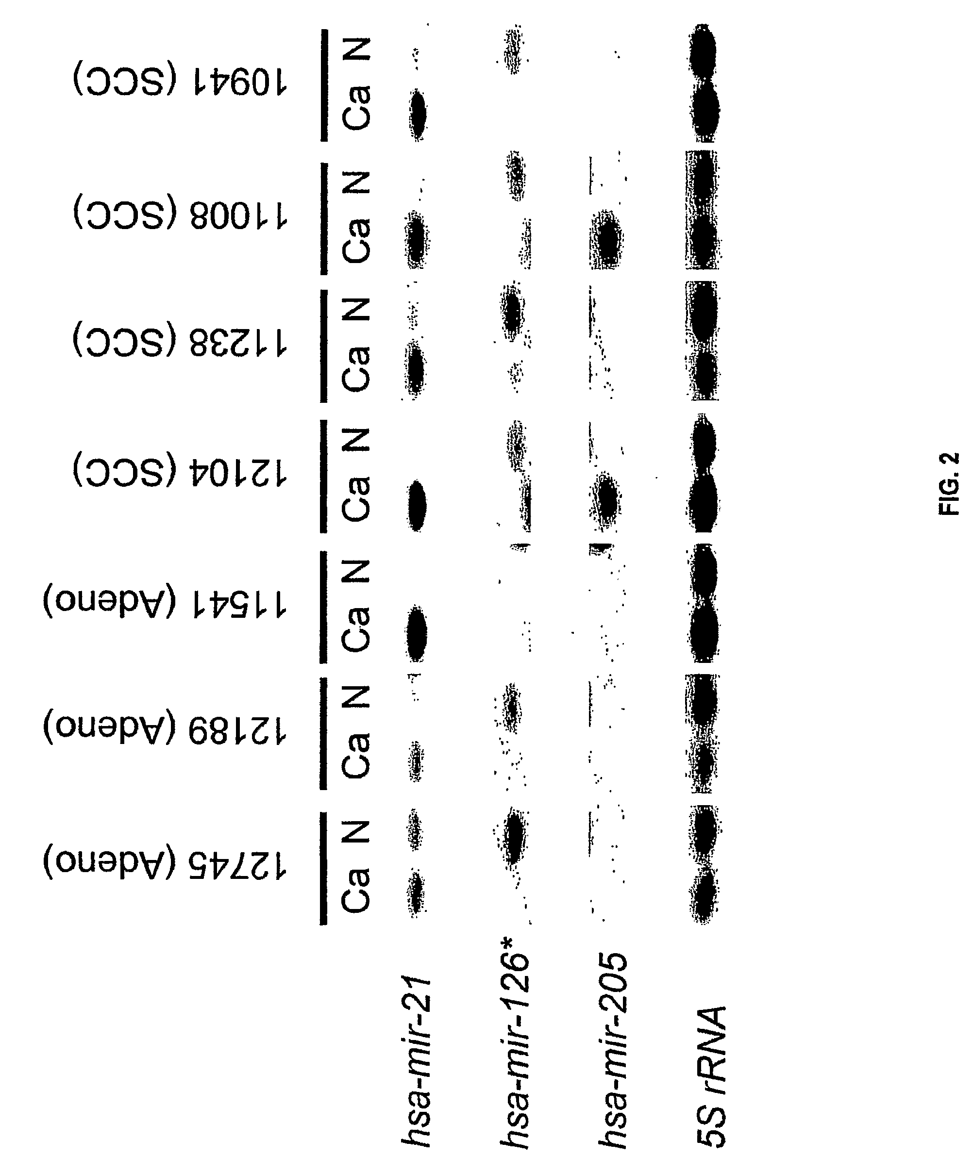 Microrna-based methods and compositions for the diagnosis, prognosis and treatment of lung cancer