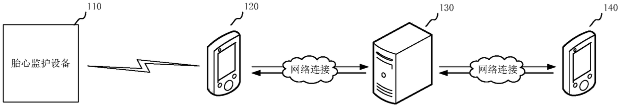 Fetal heart monitoring data processing method, device, system, storage medium and computer equipment