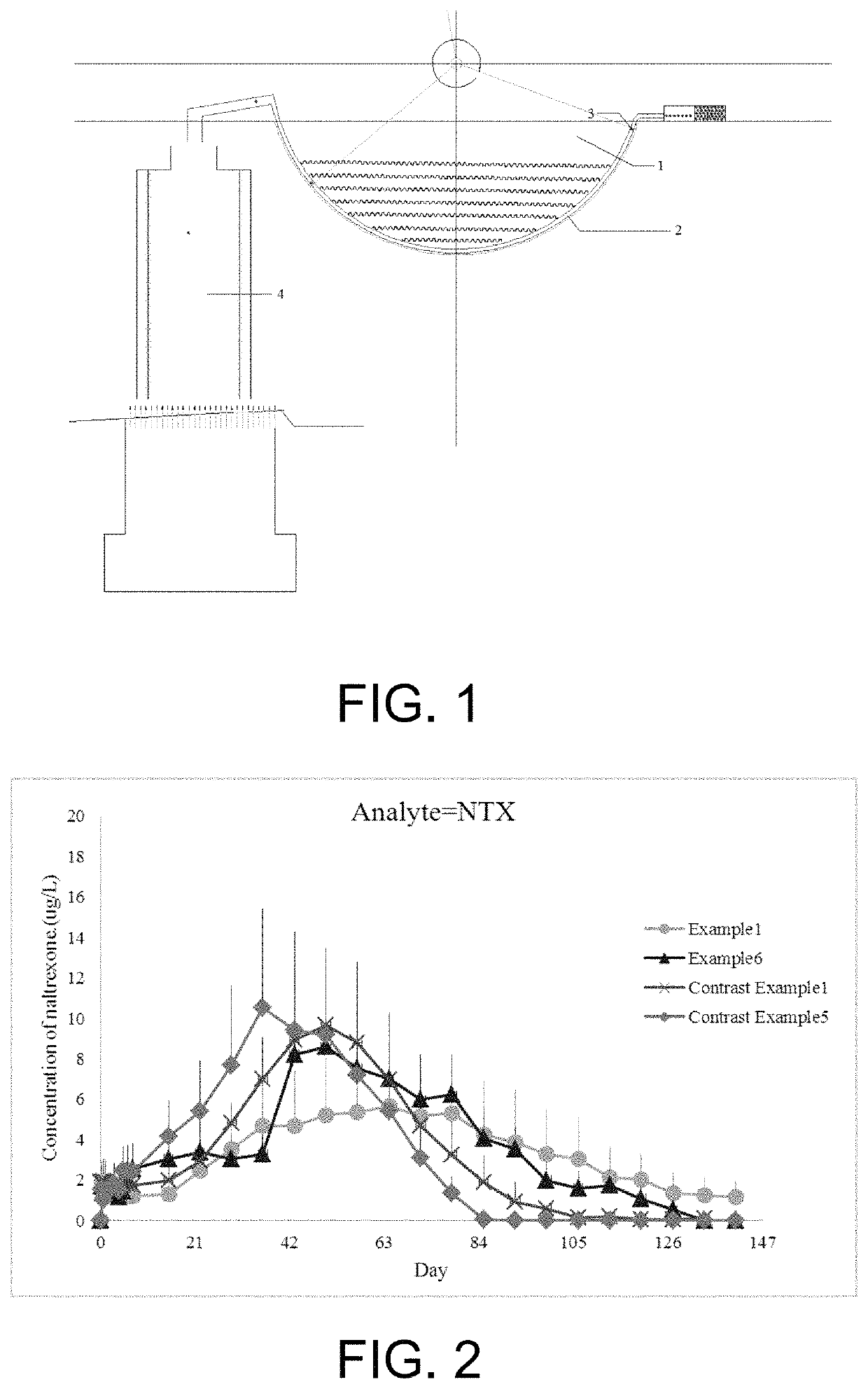 Preparation method of naltrexone implants