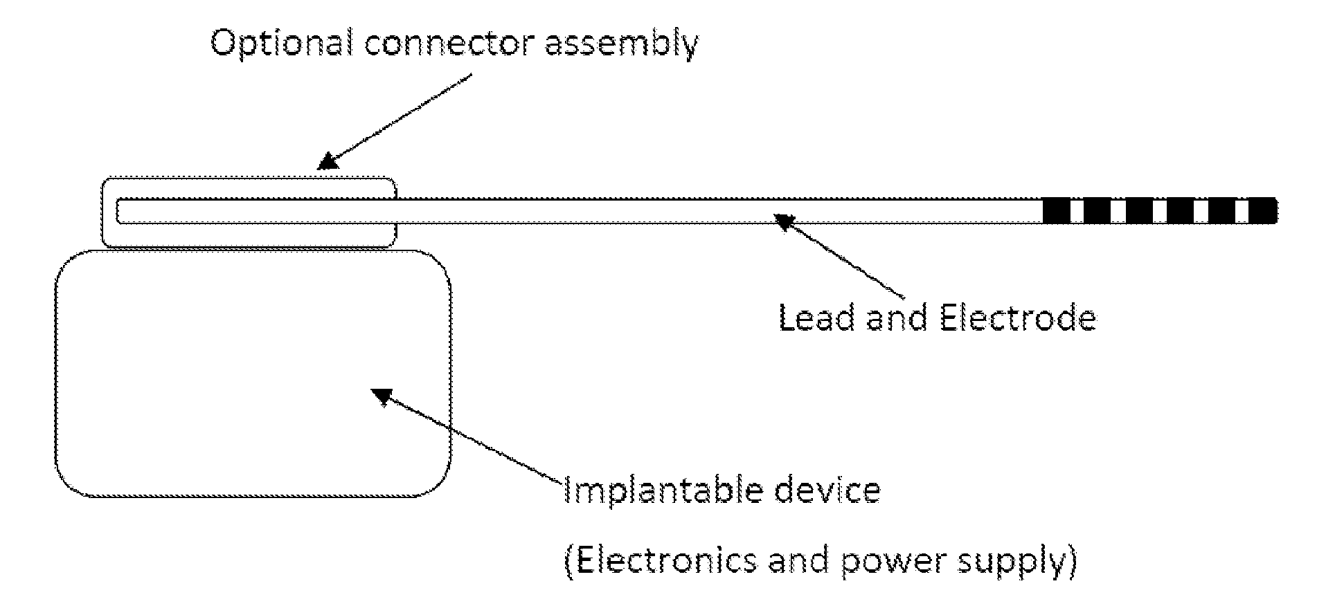 Electrode Assembly for an Active Implantable Medical Device