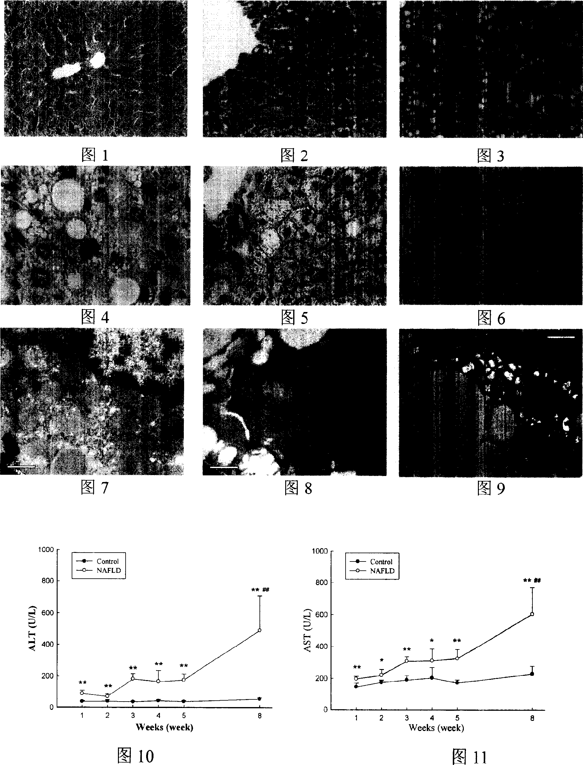 Process for preparing non-alcohol fatty liver mouse model