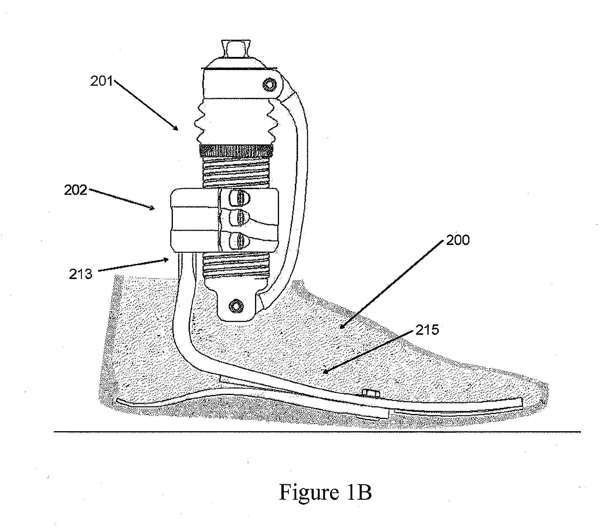 Frictionless vertical suspension mechanism for prosthetic feet