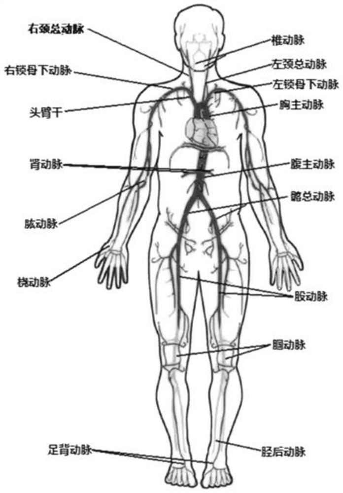 Non-invasive arteriosclerosis detection method and device based on one-way pulse wave