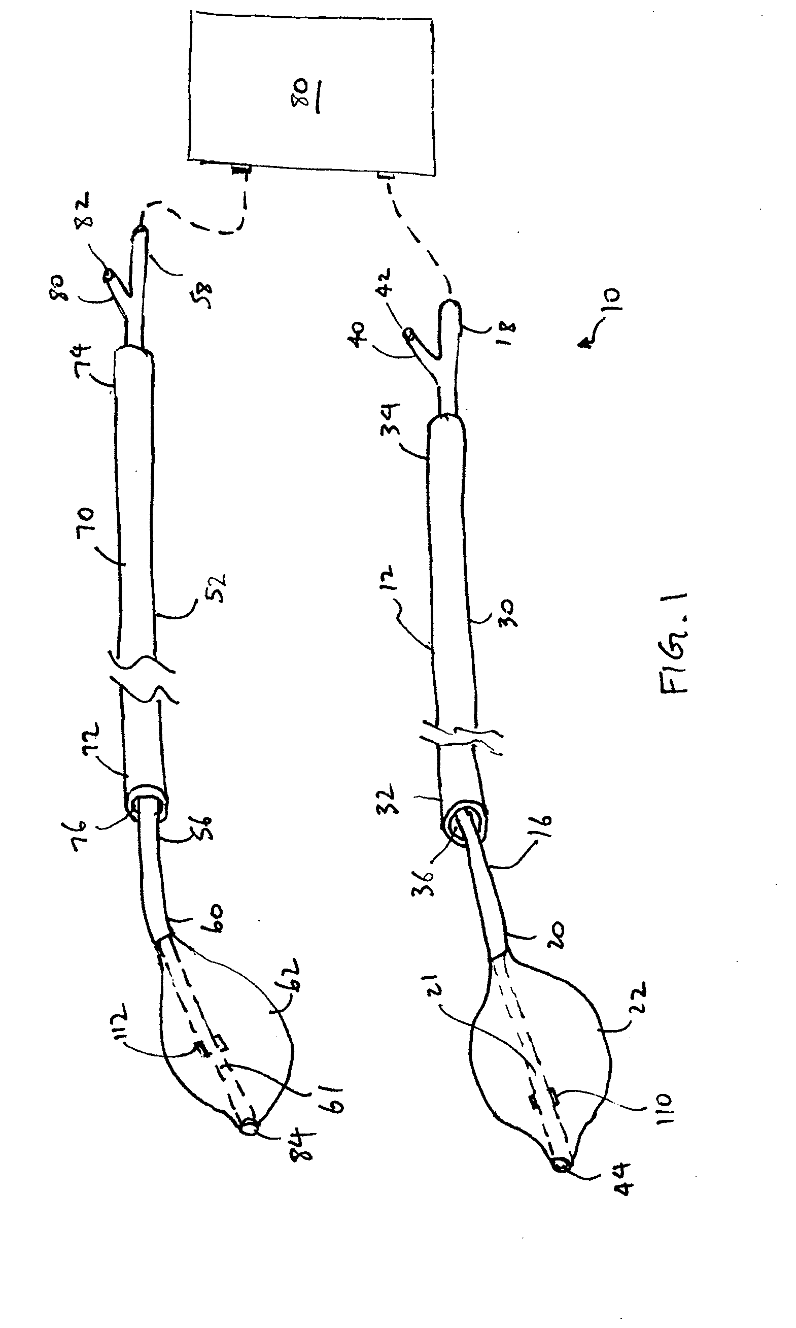 Method for tissue cryotherapy