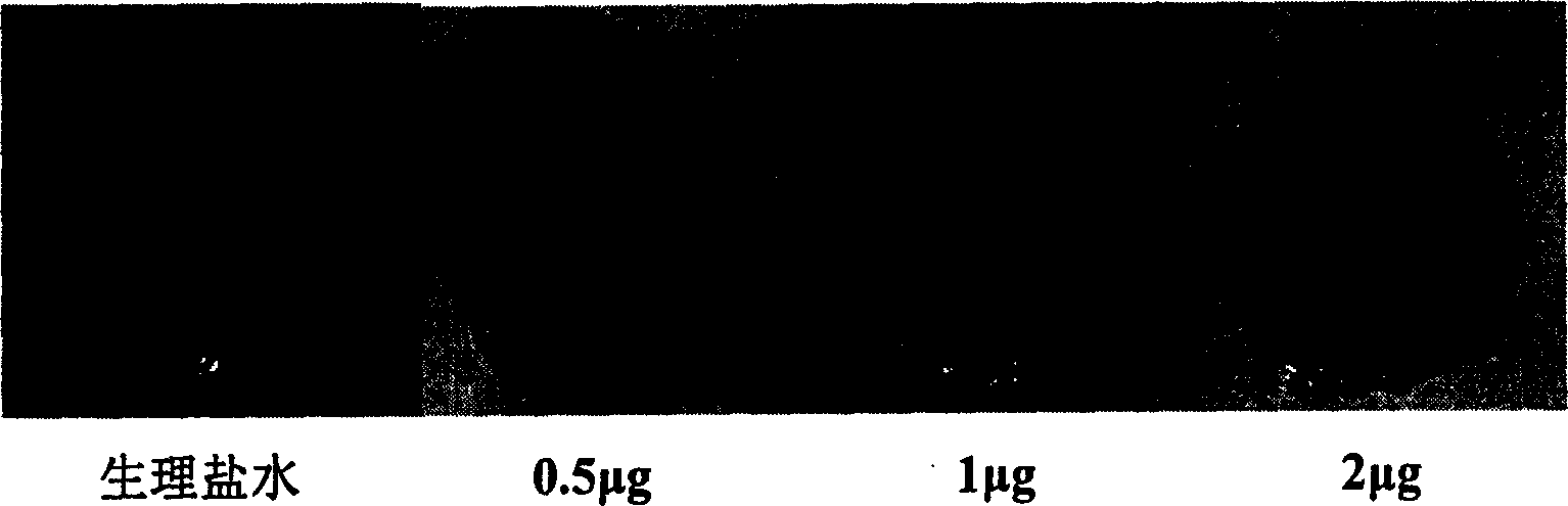 Method for producing recombined endothelium chalone in bacillus colis and application