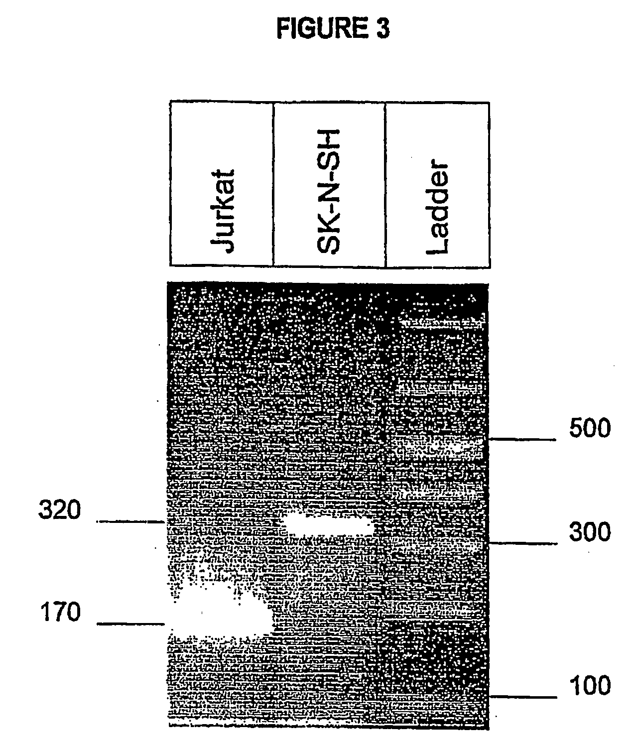 T Type Calcium Channel Inhibitors