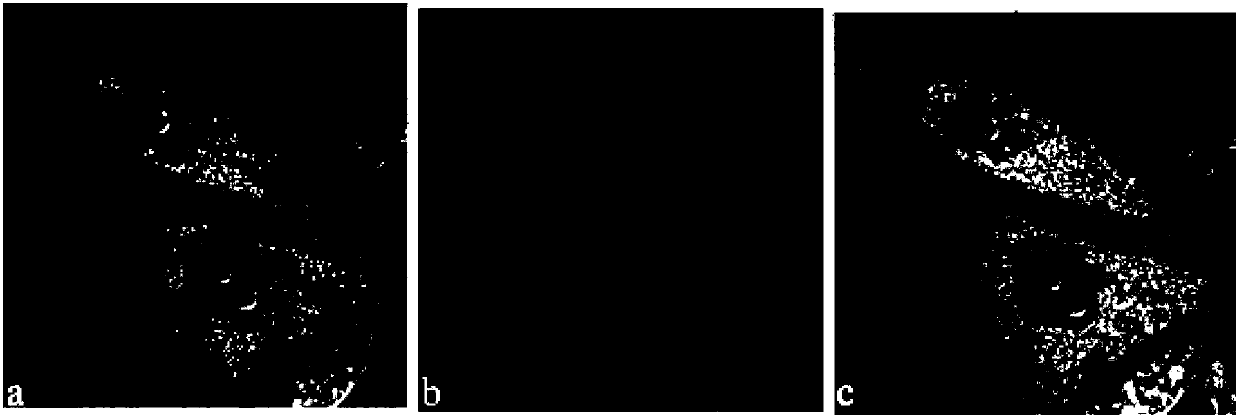 Fluorescence dye using fluorescein as matrix, and preparation method and application thereof