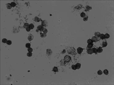 In-situ hybridization assay kit for premalignant lung cancer 14-3-3thta level as well as assay method and application