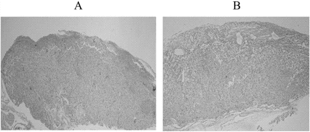 Application of anti-ENO1 (alpha-enolase) autoantibody in AIT (autoimmune thyroiditis) pregnant woman screening and abortion risk prediction