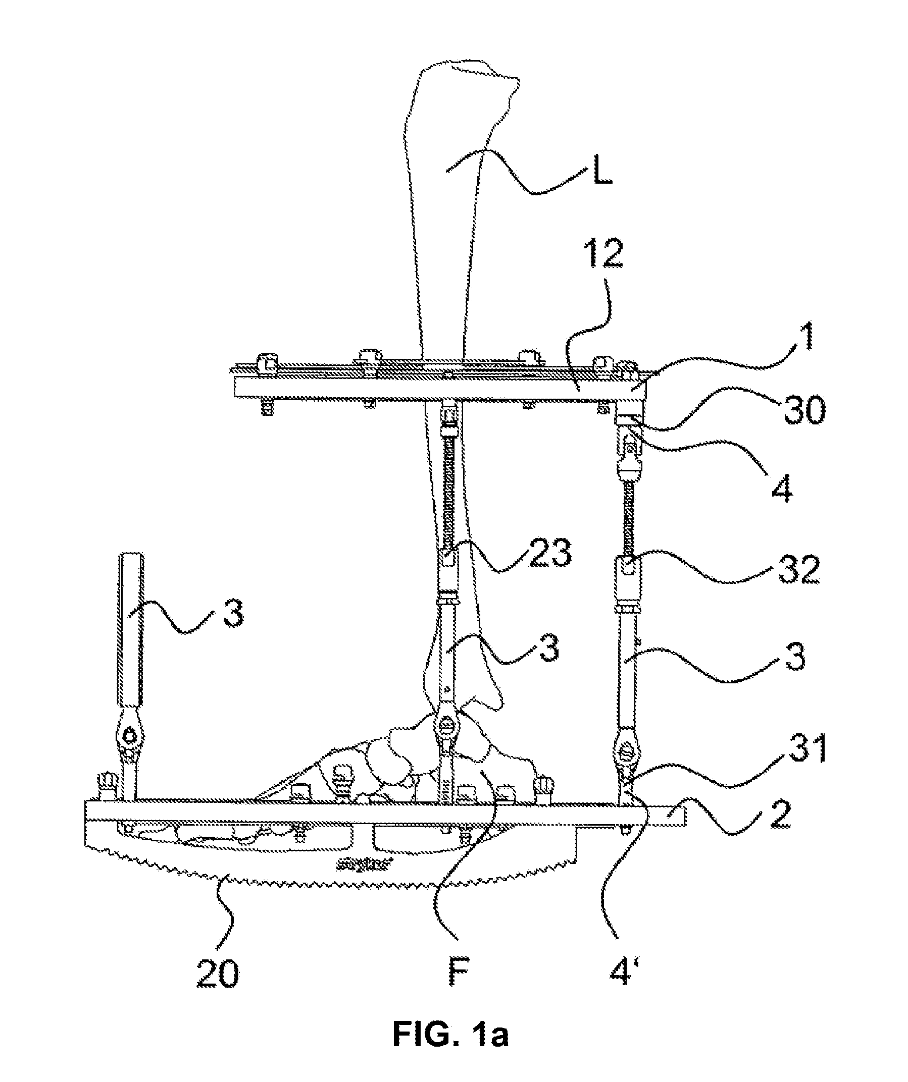 External fixator system