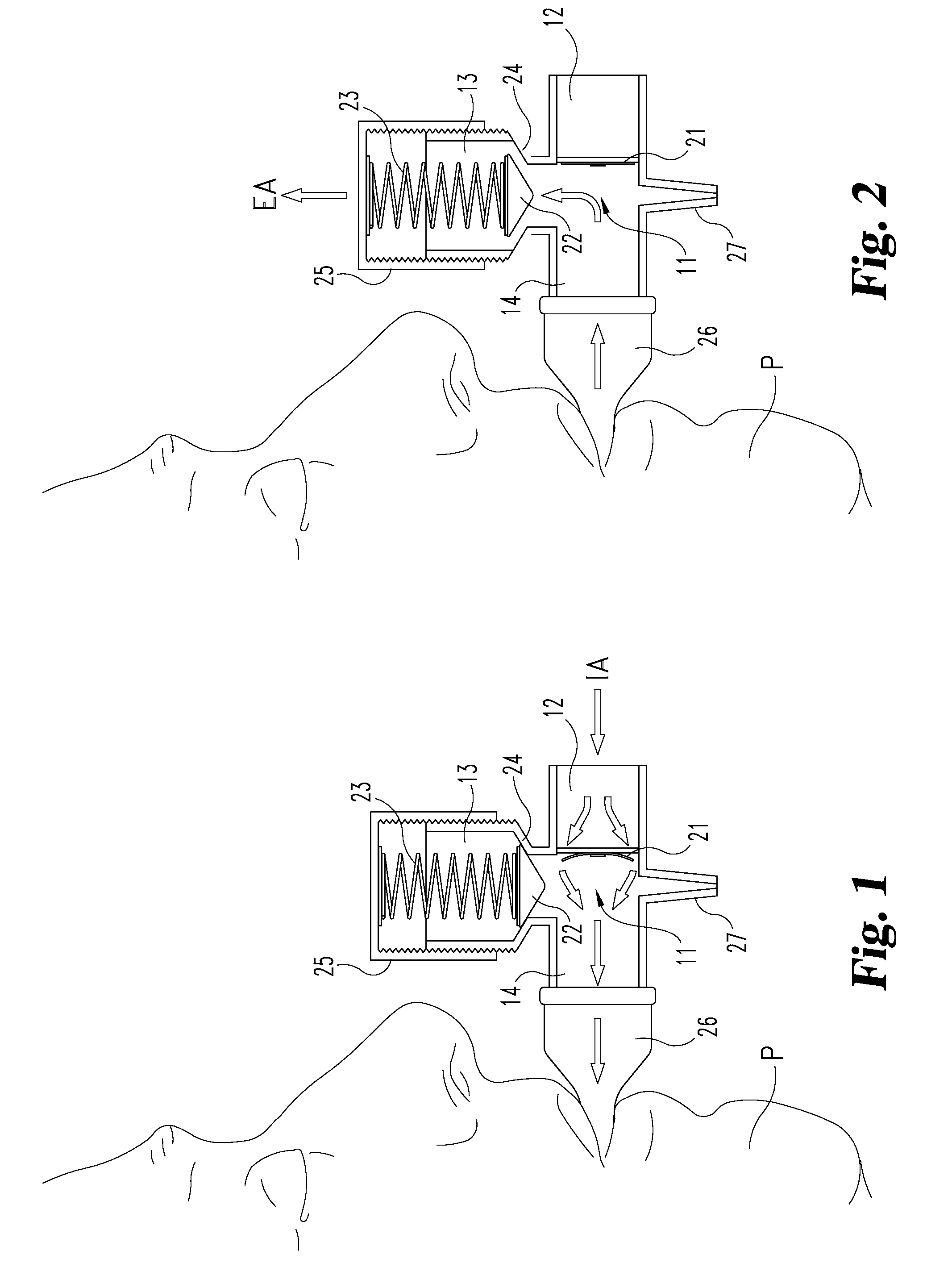 Airway pressure control devices