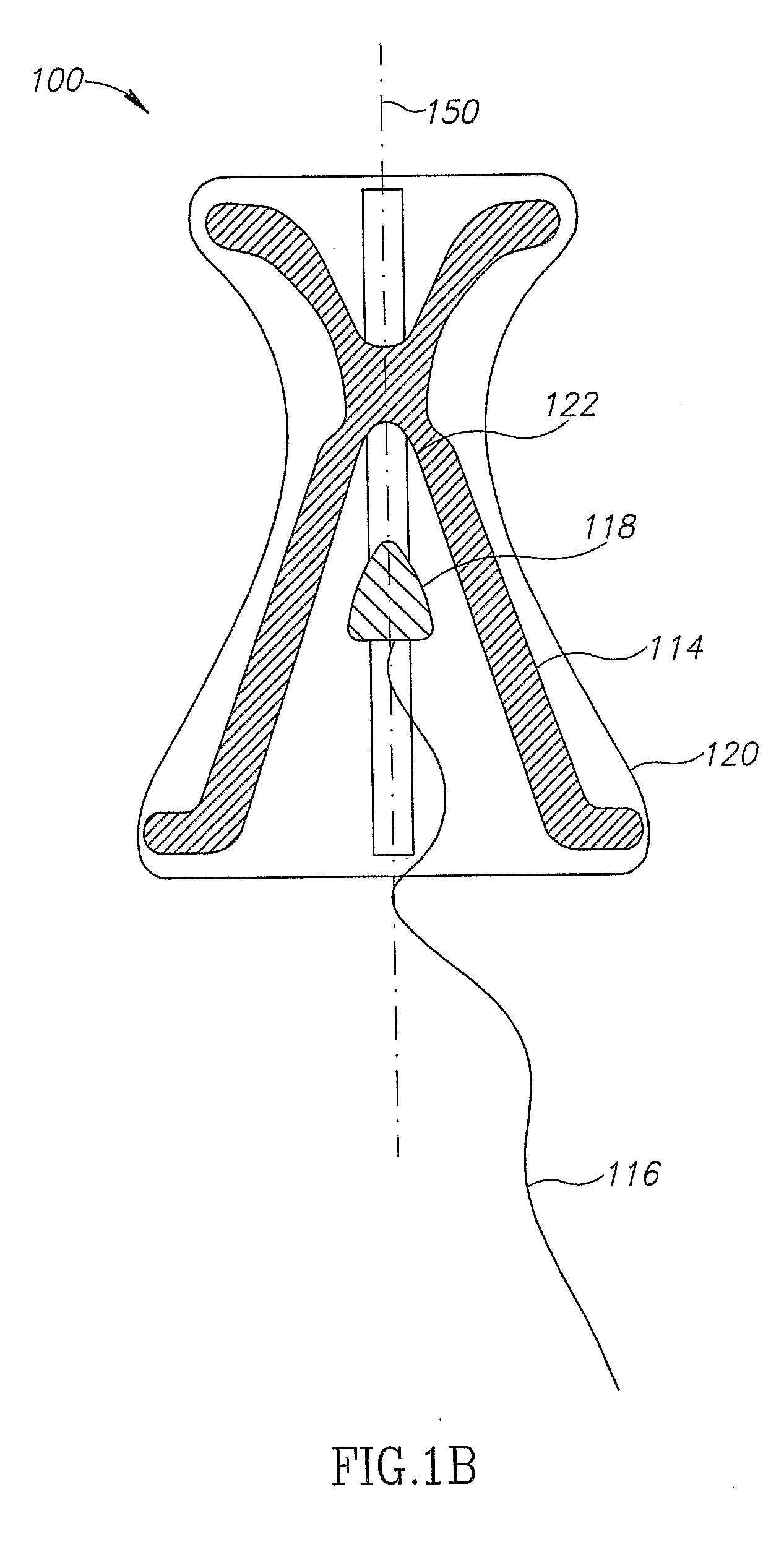 Apparatuses for the Amelioration of Urinary Incontinence in Females