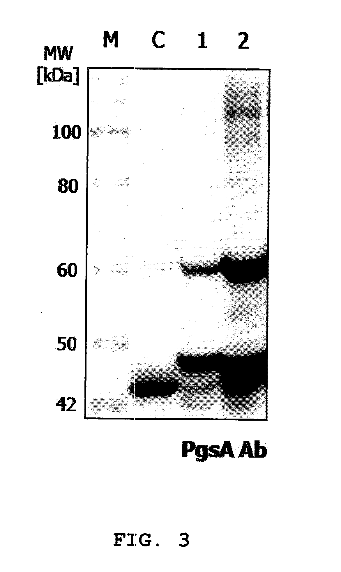 Vector for treatment vaccine for stable and constitutive high-expression cervical cancer and recombinant lactobacillus transformed by the same