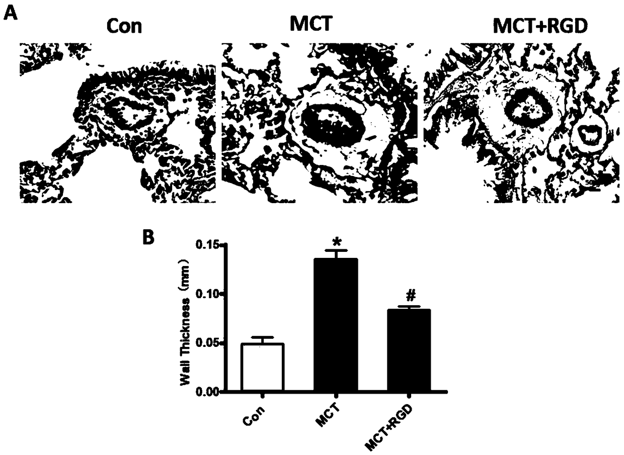 Application of exogenous Cyclo(-RGDfK) polypeptide to preparation of medicines for preventing and treating hypertensive pulmonary arterial disease