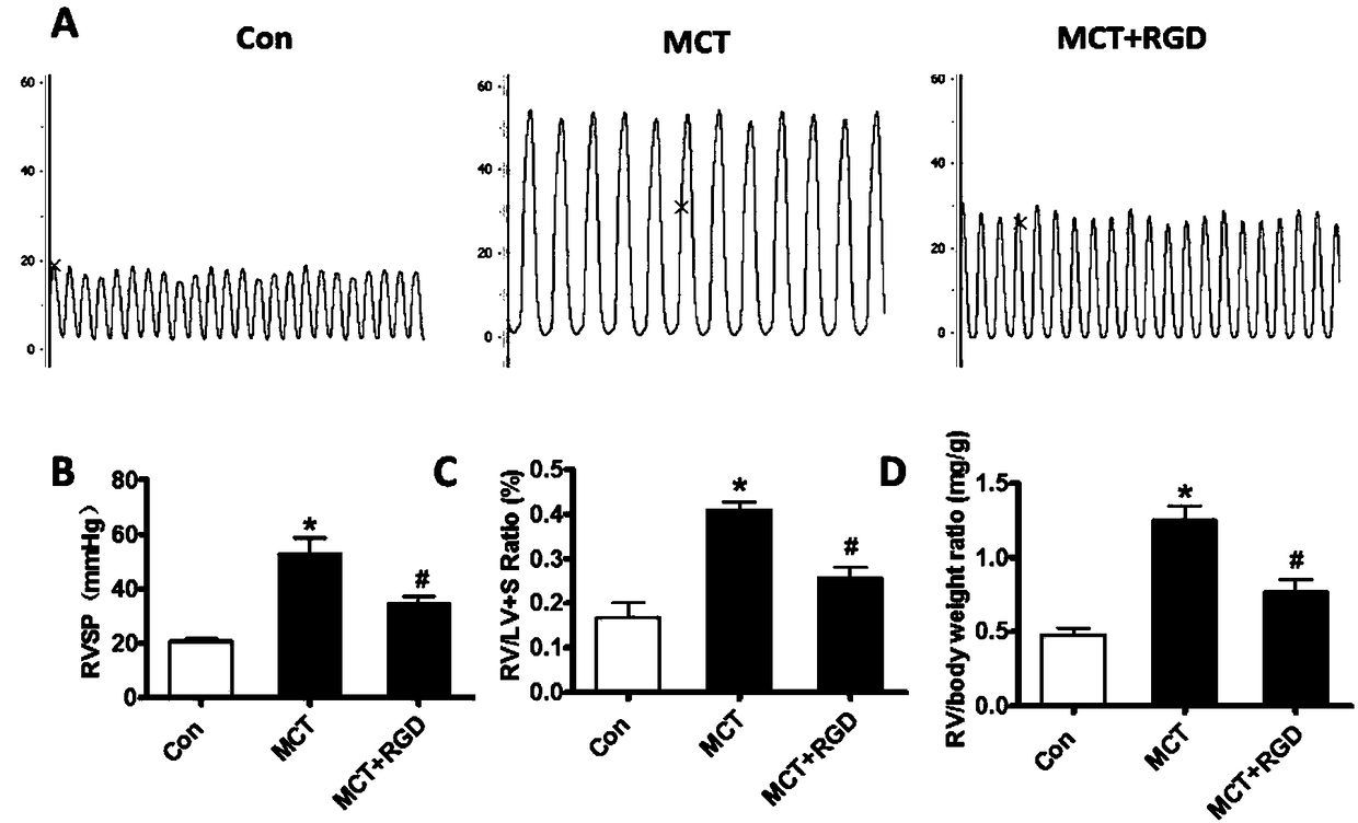 Application of exogenous Cyclo(-RGDfK) polypeptide to preparation of medicines for preventing and treating hypertensive pulmonary arterial disease