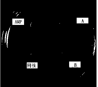 Antibacterial peptide and application thereof