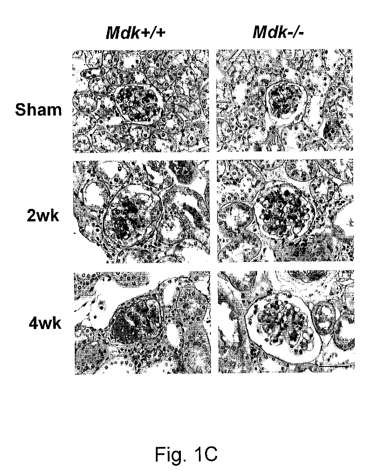 Therapeutic Method Targeting Midkine