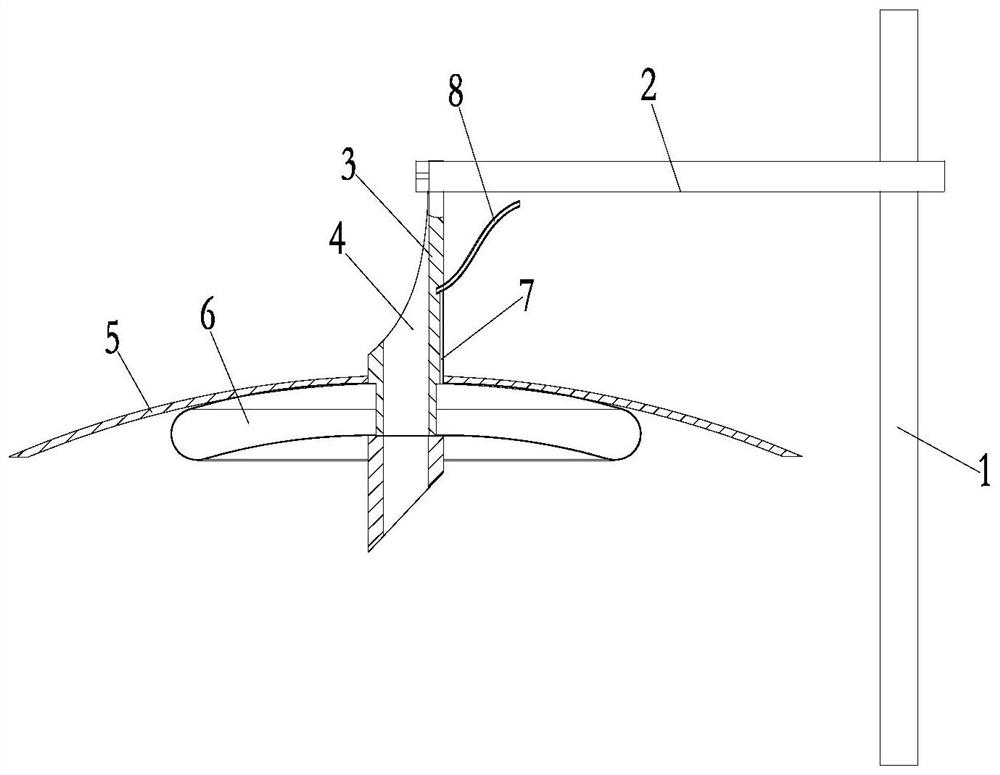 Non-laparoscopic pneumoperitoneum hanger