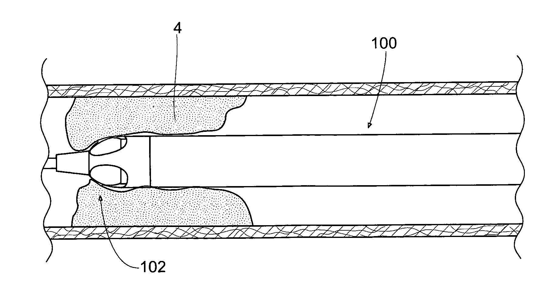 Atherectomy devices and methods