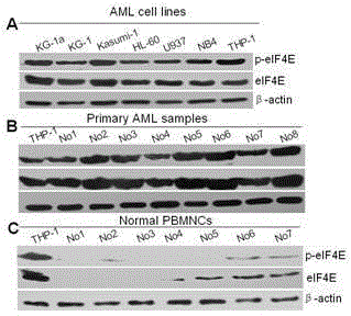 Application of homoharringtonine-type compounds in antitumor drug preparation