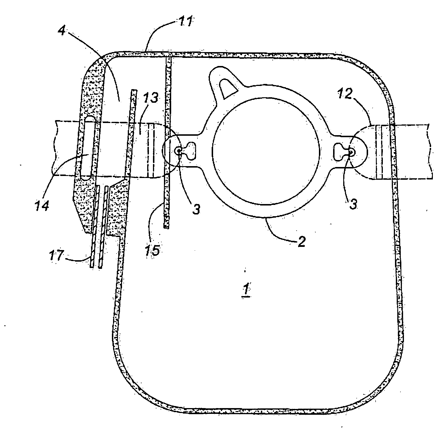 Colostomy bag