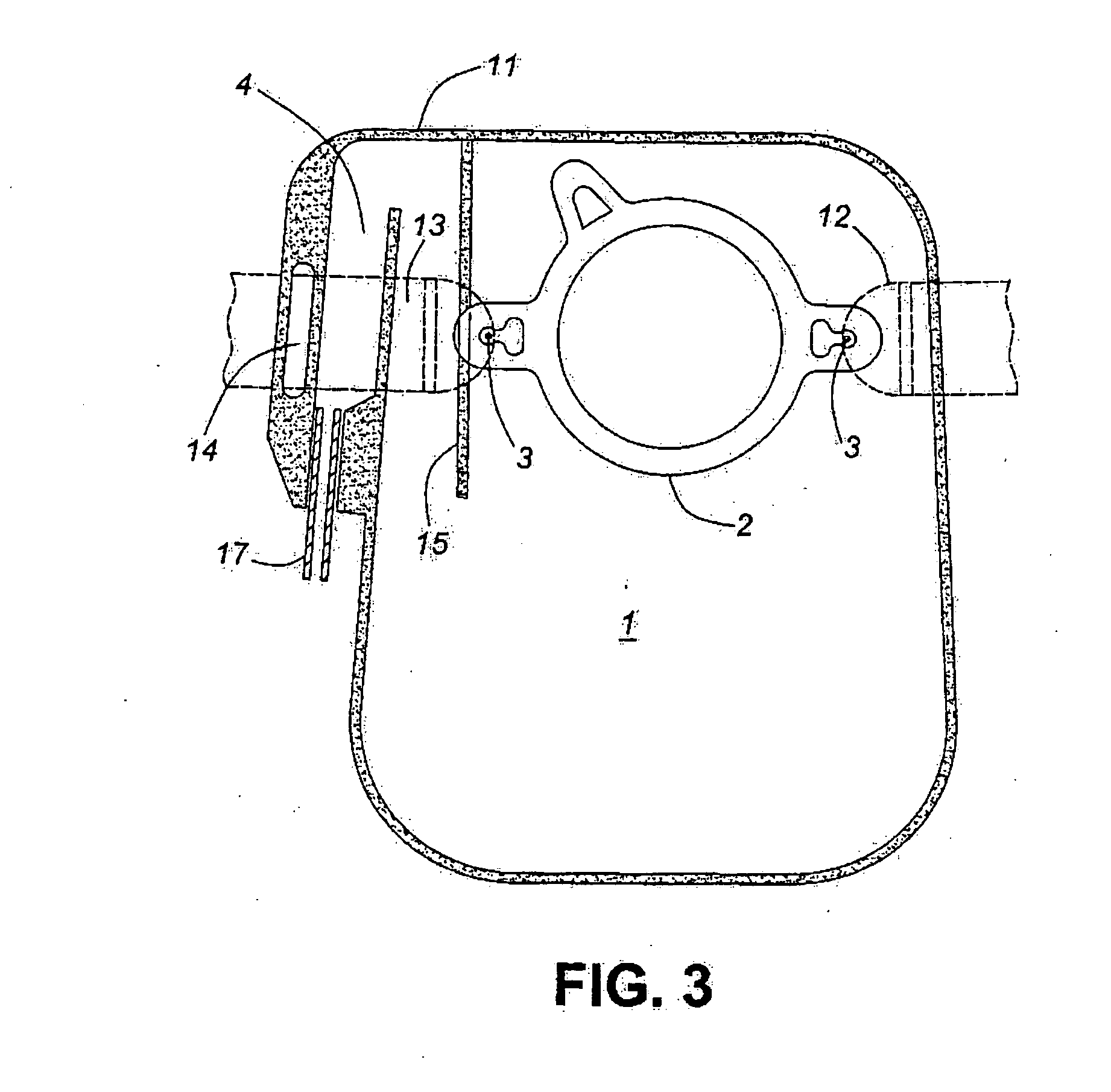 Colostomy bag