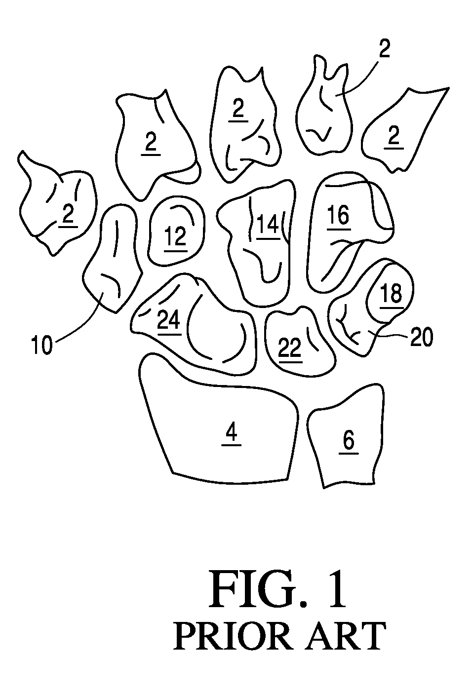 Bone prosthesis for maintaining joint operation in complex joints