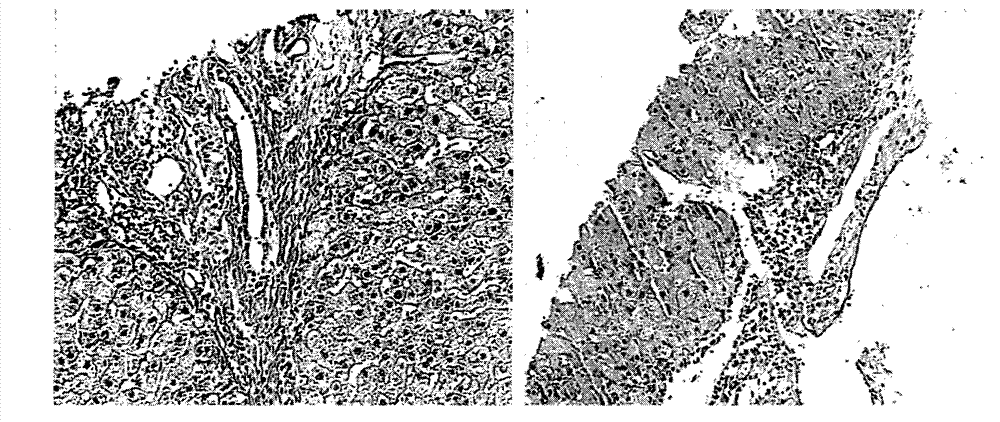 Medicine for regulating liver regeneration and preparation method of medicine