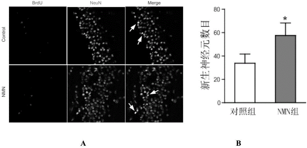 Application of nicotinamide mononucleotide in preparation of medicines for promotion of nerve regeneration after cerebral ischemia