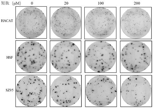 Application of small-molecule oligopeptide in preparing product for treating acnes