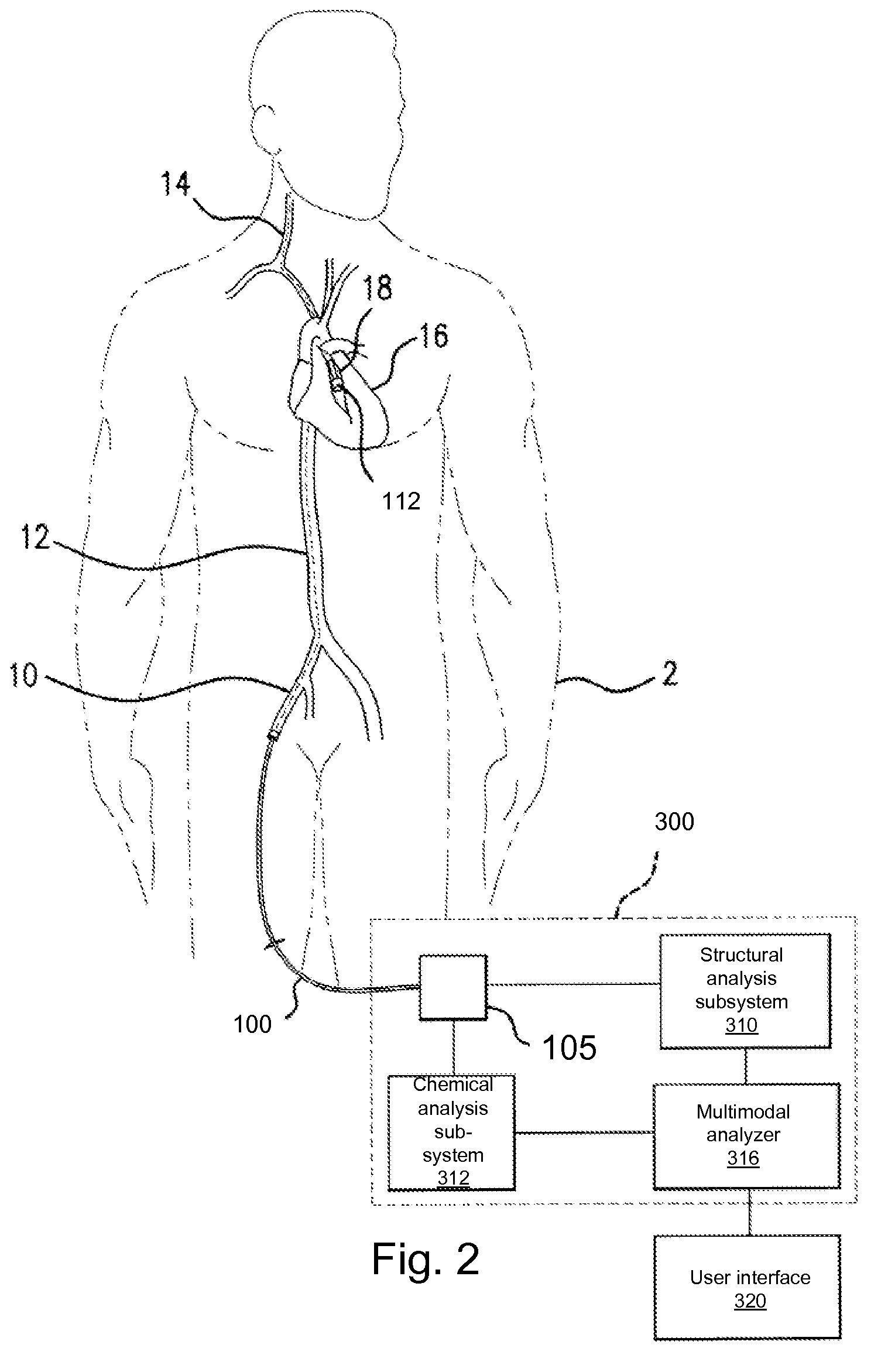 System and Method for Intravascular Structural Analysis Compensation of Chemical Analysis Modality