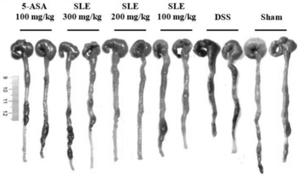 Pharmaceutical composition for treating ulcerative colitis and application thereof