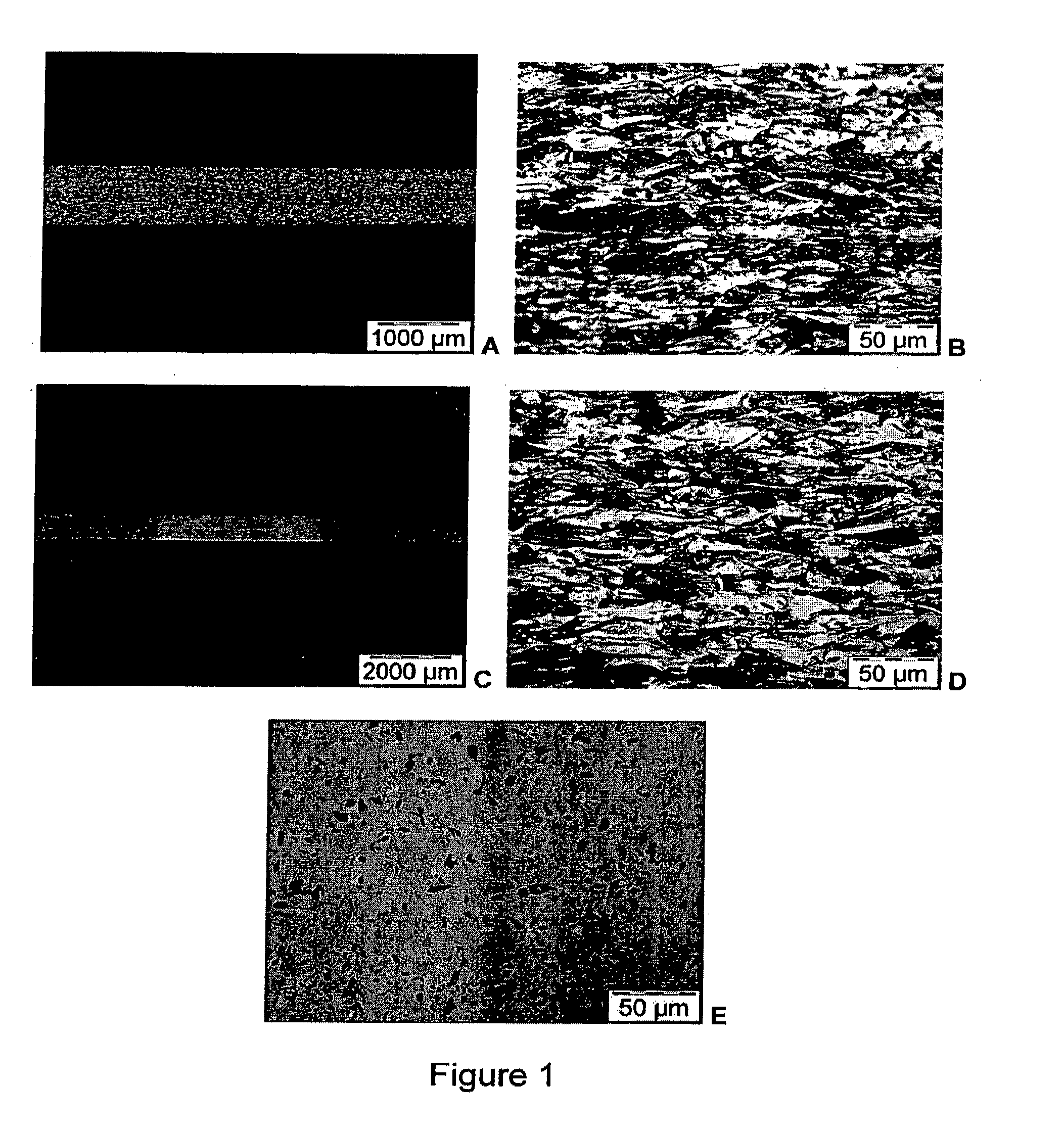 Stainless steel having local variations in mechanical resistance