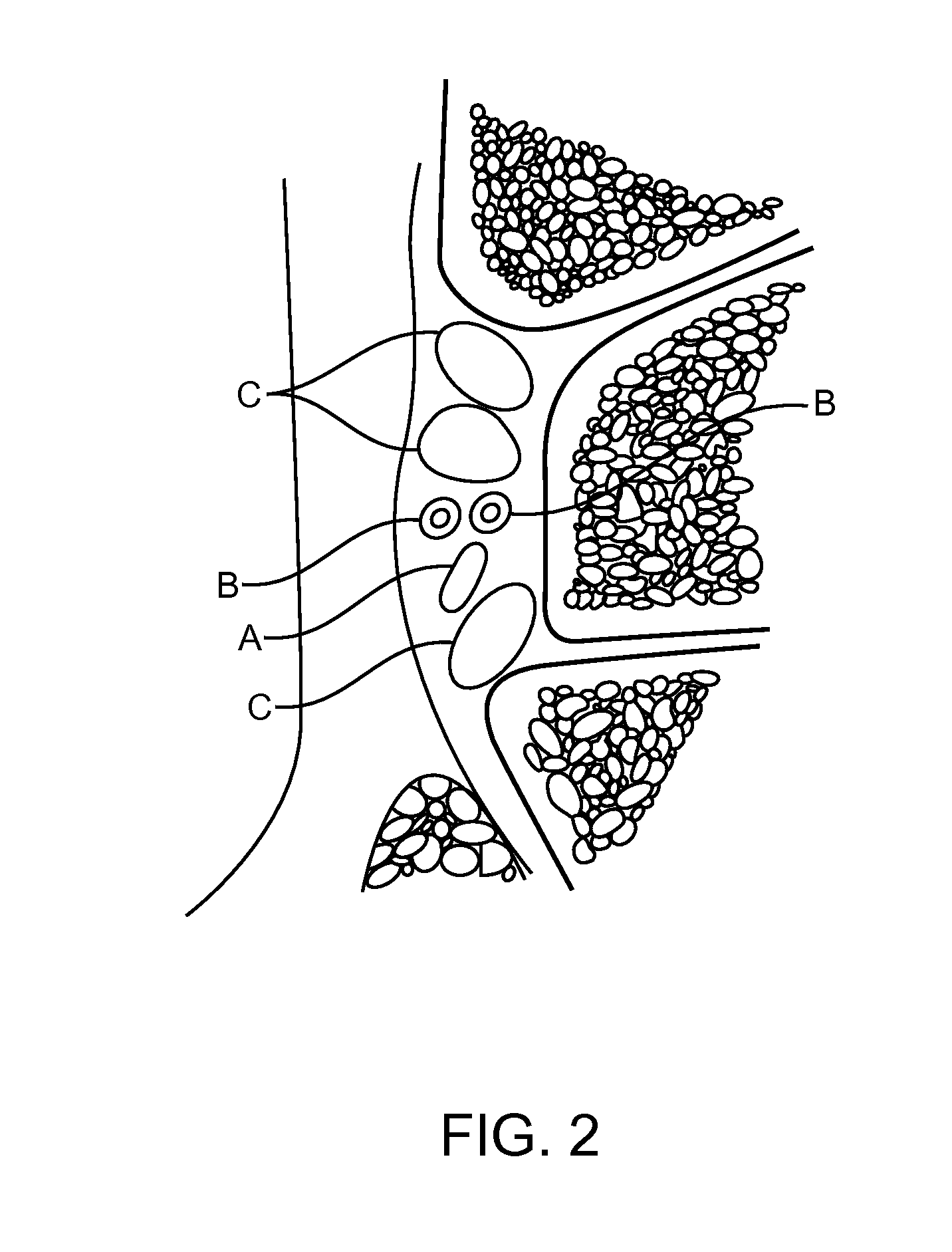 Methods and Compositions for Treating Foot or Hand Pain