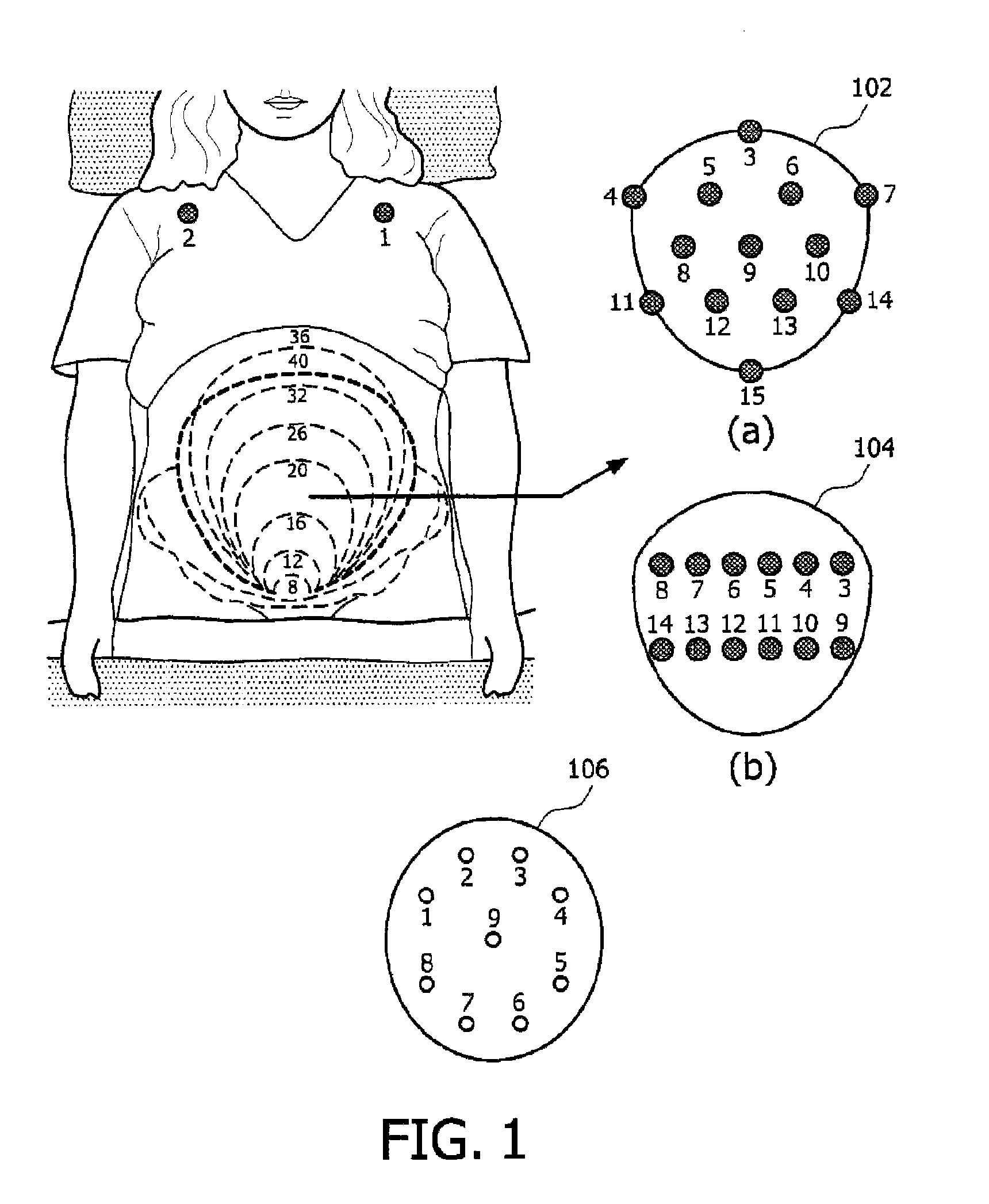 Fetal monitoring