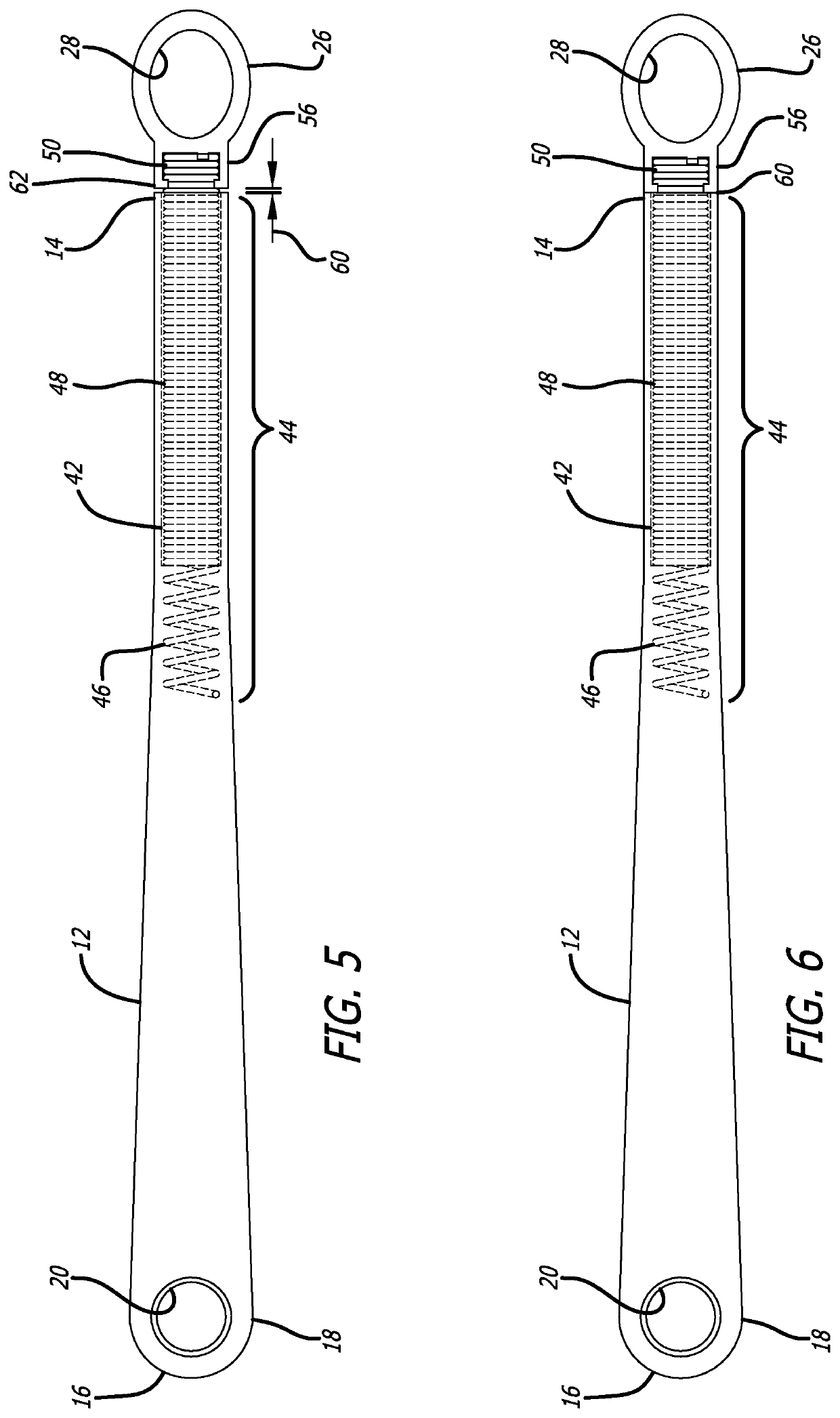 Orthodontic appliance and method of use